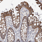 Anti-TTC21B Antibody