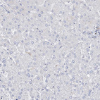 Anti-TTC21B Antibody