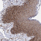 Anti-NFU1 Antibody