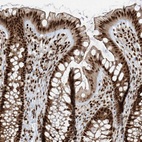 Anti-FAM193B Antibody