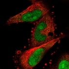 Anti-FAM193B Antibody