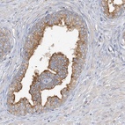 Anti-SIDT1 Antibody