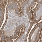 Anti-THG1L Antibody