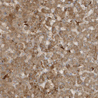 Immunohistochemical staining of human liver shows moderate granular cytoplasmic positivity in hepatocytes.