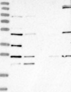 Anti-LYAR Antibody