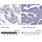 Anti-LYAR Antibody