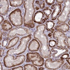 Anti-FAM196A Antibody