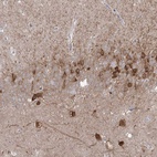 Anti-PCDHA1 Antibody