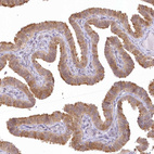 Anti-RNPEP Antibody