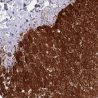 Anti-ASNSD1 Antibody