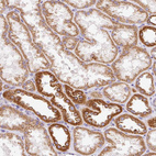 Immunohistochemical staining of human kidney shows strong granular cytoplasmic positivity in cells in tubules.