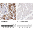 Anti-GLS Antibody