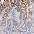 Anti-GLS Antibody