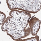 Anti-WDR49 Antibody