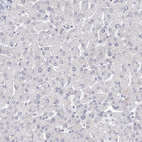 Anti-SLC7A7 Antibody