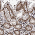 Anti-CCDC152 Antibody