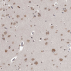 Anti-CCDC152 Antibody