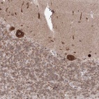 Anti-DNAJB2 Antibody