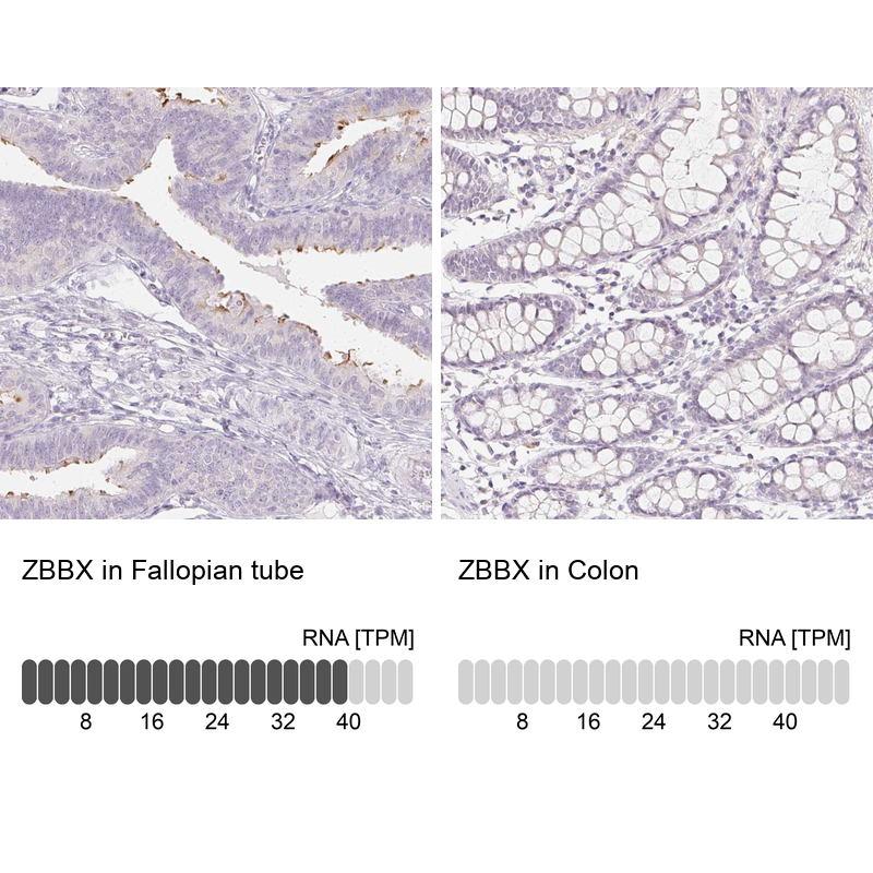 Anti-ZBBX Antibody