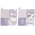 Anti-ZBBX Antibody