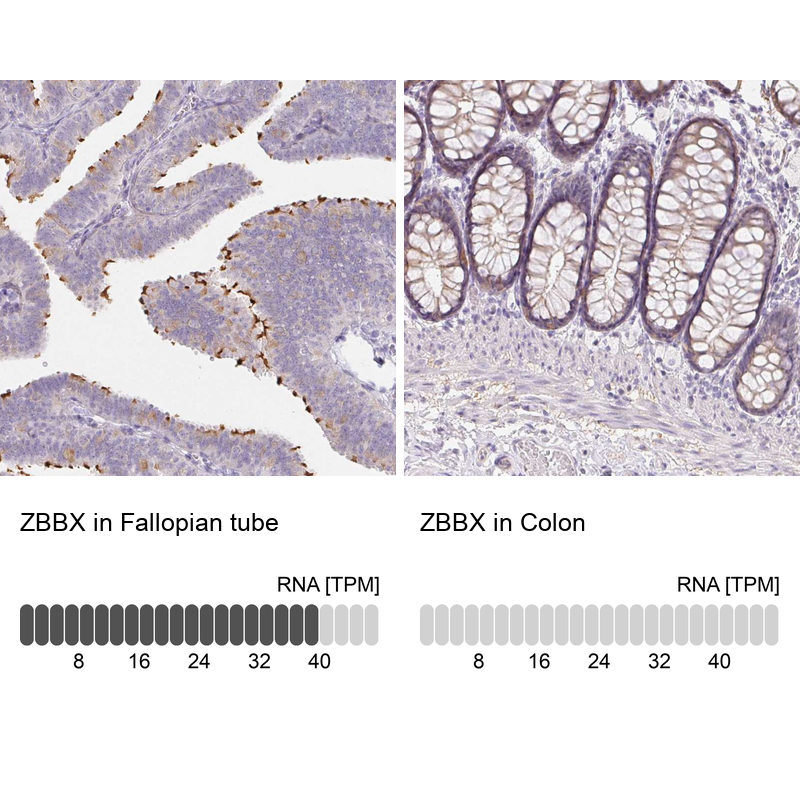 Anti-ZBBX Antibody