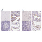 Anti-ZBBX Antibody