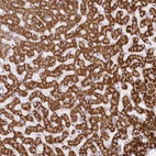 Anti-CCDC30 Antibody