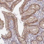 Anti-CCDC30 Antibody