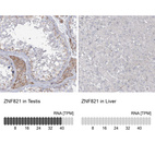 Anti-ZNF821 Antibody