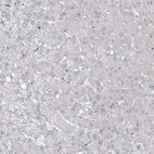 Anti-ZNF821 Antibody