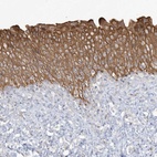 Anti-LARS Antibody