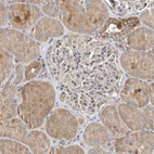 Anti-SCFD2 Antibody