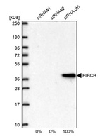 Western blot analysis in U2OS cells transfected with control siRNA, target specific siRNA probe #1 and #2, using Anti-HIBCH antibody. Remaining relative intensity is presented.