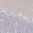 Anti-CXXC4 Antibody