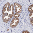 Anti-UGDH Antibody