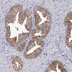 Anti-UGDH Antibody