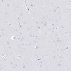 Anti-UGDH Antibody