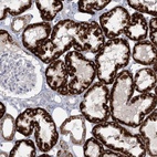 Anti-BPHL Antibody