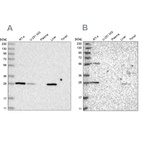 Anti-BPHL Antibody