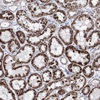 Anti-BPHL Antibody