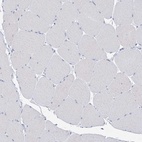 Anti-BPHL Antibody