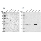 Anti-BPHL Antibody