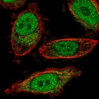 Anti-BPHL Antibody