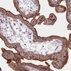 Anti-RNPEPL1 Antibody