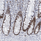 Anti-HAT1 Antibody