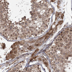 Anti-DNAJC27 Antibody