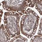 Anti-DNAJC27 Antibody