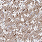 Anti-GPAT2 Antibody