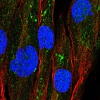 Anti-GPAT2 Antibody