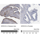 Anti-SPATA18 Antibody